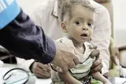 گرسنگی، ۲۰ میلیون یمنی را تهدید می‌کند