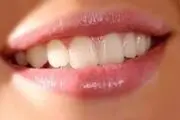 این ماده مغذی محافظ لثه است