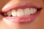 این ماده مغذی محافظ لثه است