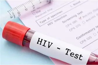  ۳ علت اصلی ابتلا به ایدز در کشور