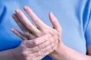 چرا انگشتان دستمان خواب می رود؟