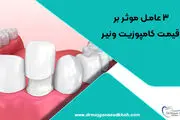 3 عامل موثر بر قیمت کامپوزیت ونیر


