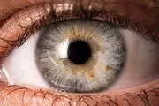 شایع‌ترین علت‌های تنبلی چشم