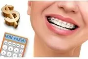 عوامل تاثیر گذار در هزینه ارتودنسی