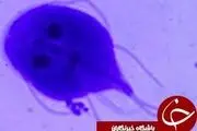 میکروب‌هایی که داخل روده ها زندگی می‌کنند+تصاویر 