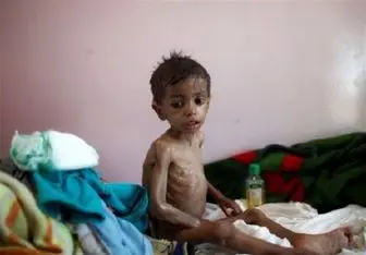  کودکان یمنی در شرایطی زندگی می‌کنند که هیچ انسانی آن را تحمل نمی‌کند