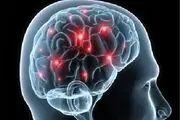 علائم سکته مغزی را بشناسیم