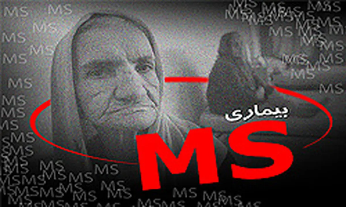 اگر این نشانه‌ها را دارید مشکوک به بیماری ام‌ اس هستید