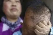زندگی پیرمردی که با گذشت زمان کودک می شود! /تصاویر+18