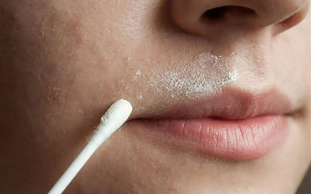  موهای پشت لب را با این نسخه‌های گیاهی و خانگی کامل رفع کنید
