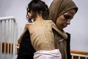 توصیف دردناک سازمان ملل از وضعیت غزه