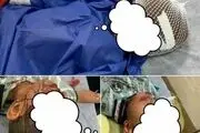 سگ هار پوست سر کودک ۷ ساله بندرعباسی را کند! + عکس