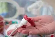افزایش خطر زایمان زودرس با استنشاق دود آتش
