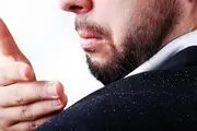 اصول درمان شوره سر به شیوه طب سنتی