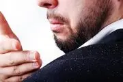6 ترفند خانگی برای خلاصی از شوره سر