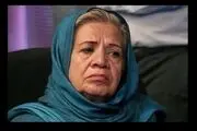 گریم سنگینس که خانم بازیگر را راهی بیمارستان کرد!
