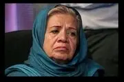 گریم سنگینس که خانم بازیگر را راهی بیمارستان کرد!
