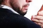 خود درمانی برای شوره سر ممنوع!
