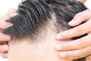 آیا سفید شدن مو قابل درمان است؟