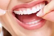 راه های مفید و لازم برای سلامتی دندان و لثه