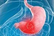 چرا زخم معده می گیریم؟