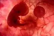تولد نوزاد حاصل از جنین فریز شده پس از 14 سال
