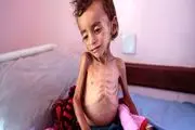 هشدار سازمان بهداشت جهانی در مورد وضع وخیم یمن
