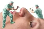 «چهره به چهره» سریالی درمورد عمل زیبایی