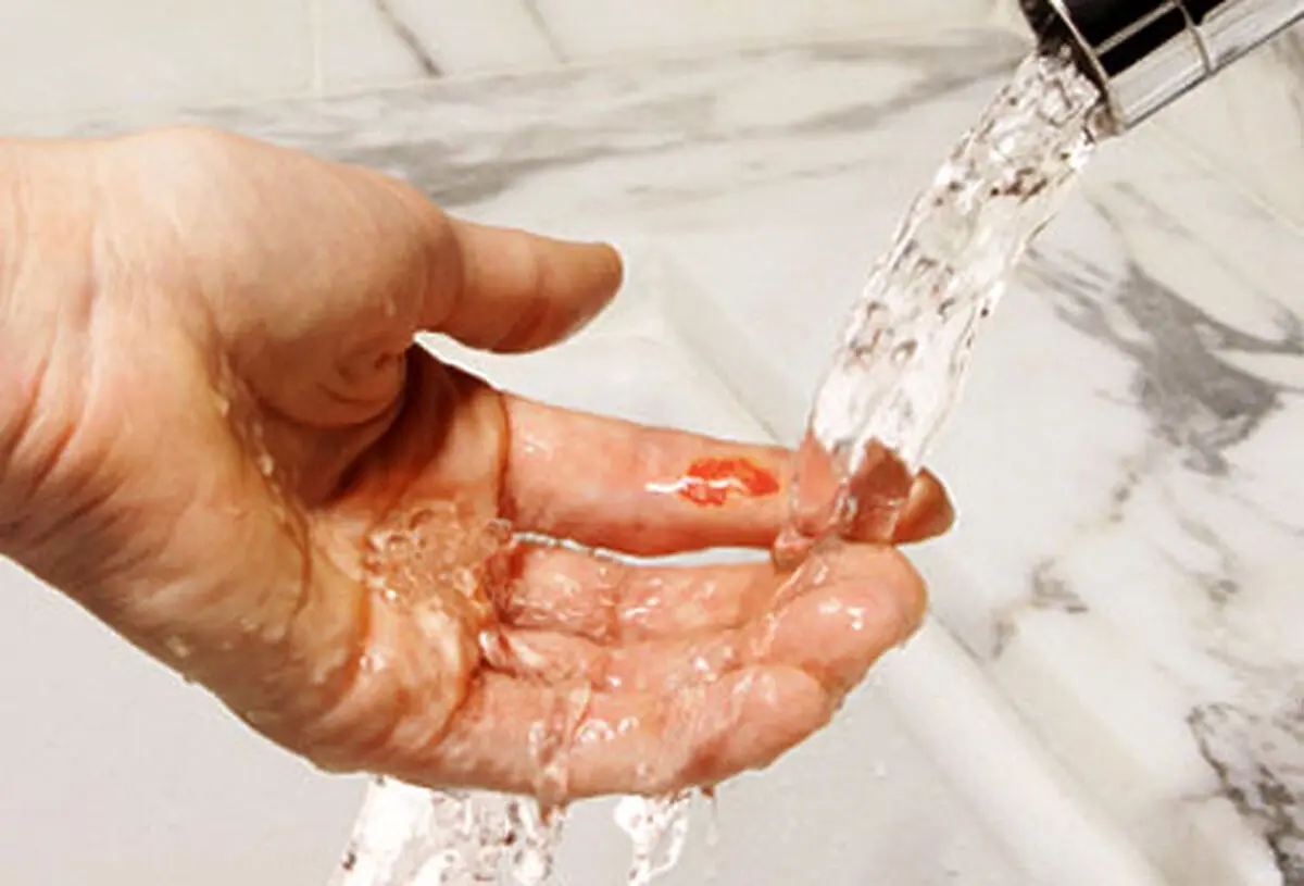 چگونه در منزل از خونریزی جلوگیری کنیم