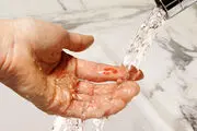 آیا خونى که بر روى زخم خشک مى‏ شود، نجس است؟