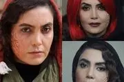 «ناک اوت» شدن خانمهای بازیگر/ از بهاره رهنما تا سامیه لک