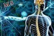 تاثیر ویتامین D در کاهش ریسک ابتلا به ام اس