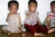 از هر ۵ کودک در کره شمالی یک نفر دچار سوتغذیه است