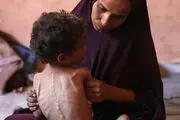 افزایش شمار شهدای گرسنگی و سوتغذیه در نوار غزه