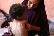 افزایش شمار شهدای گرسنگی و سوتغذیه در نوار غزه