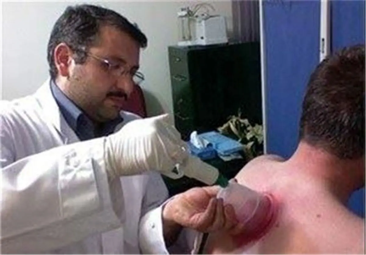 اگر قصد حجامت دارید بخوانید: شرط طلایی برای حجامت