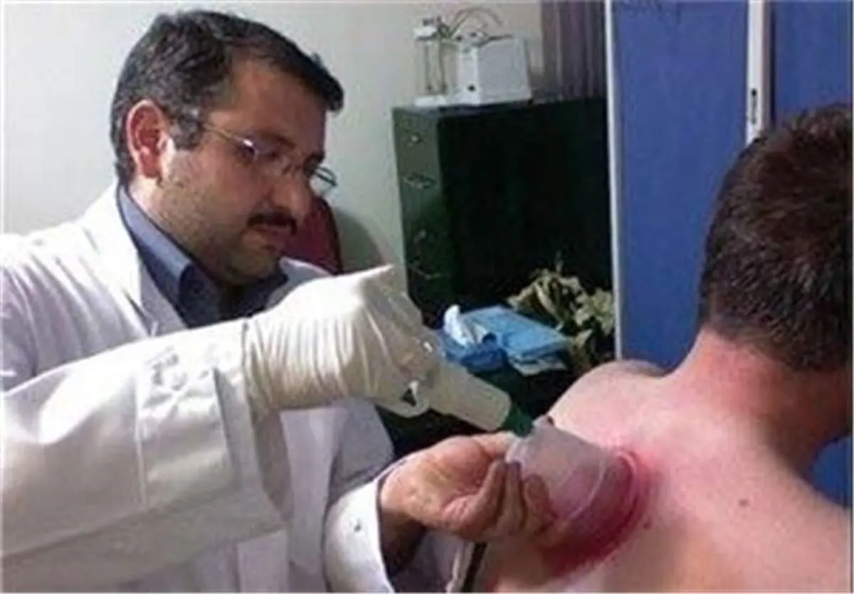 اگر قصد حجامت دارید بخوانید: شرط طلایی برای حجامت
