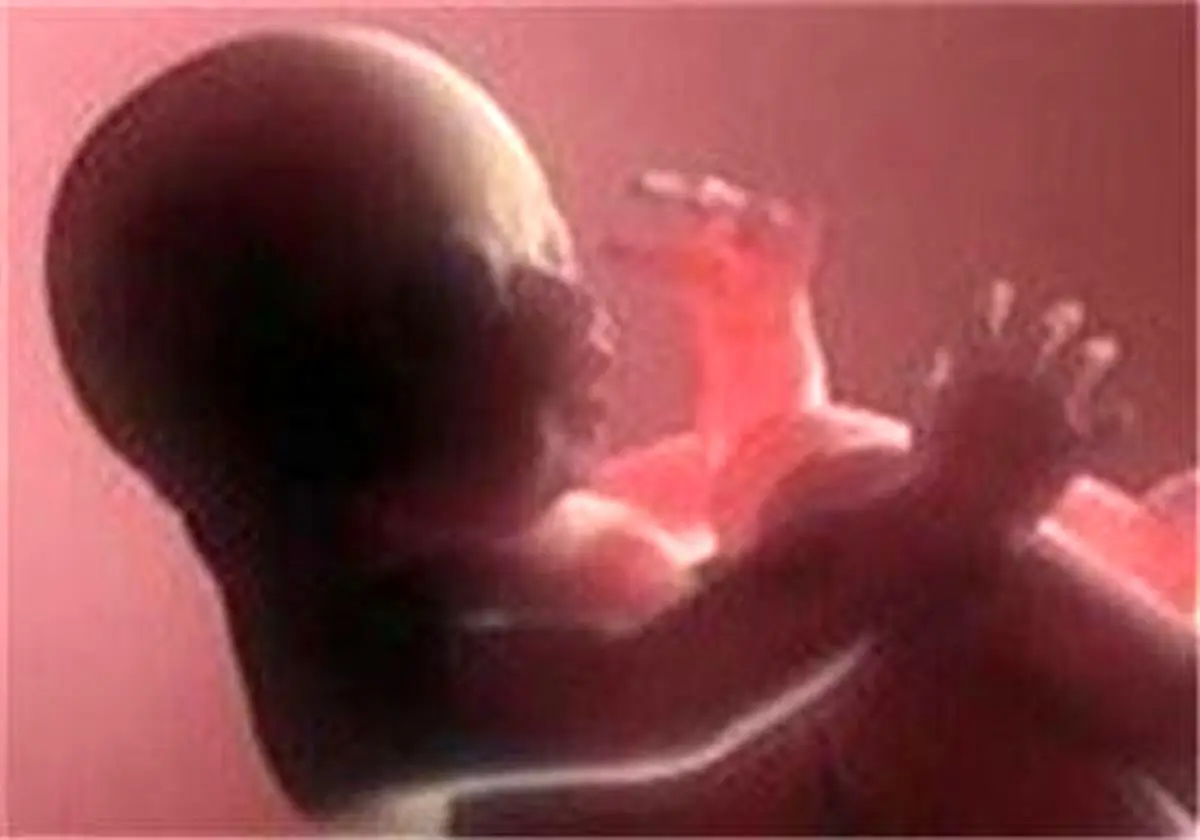 MRI در بارداری برای جنین مشکلی ایجاد نمیکند