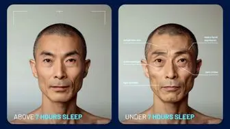 اگر ۷ ساعت خواب شبانه نداشته باشید چه اتفاقی برای صورت شما می‌افتد؟
