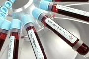 آخرین آمار کرونا در 21 خرداد99 / شناسایی 2011  مبتلای جدید به ویروس کرونا