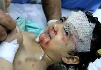 مقایسه آماری قربانیان کودک در غزه