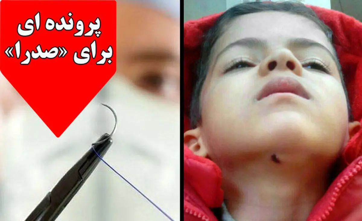 زوایایی پنهان ماجرای کودکی که بخیه اش کشیده شد