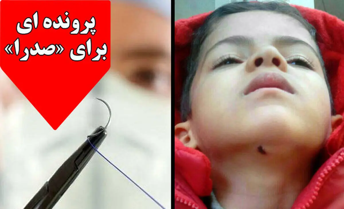 زوایایی پنهان ماجرای کودکی که بخیه اش کشیده شد