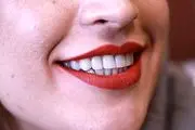 زیبایی دندان ها بدون پس انداز، اقساطی