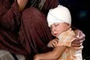 تصاویری تکان دهنده از زخم جنگ بر سر و صورت کودکان تلعفر