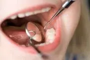 بیماری‌هایی که از طریق بزاق منتقل می‌شوند