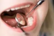 بیماری‌هایی که از طریق بزاق منتقل می‌شوند