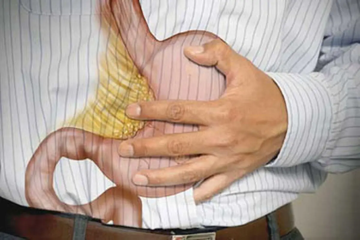 علل به وجود آمدن زخم معده چیست؟