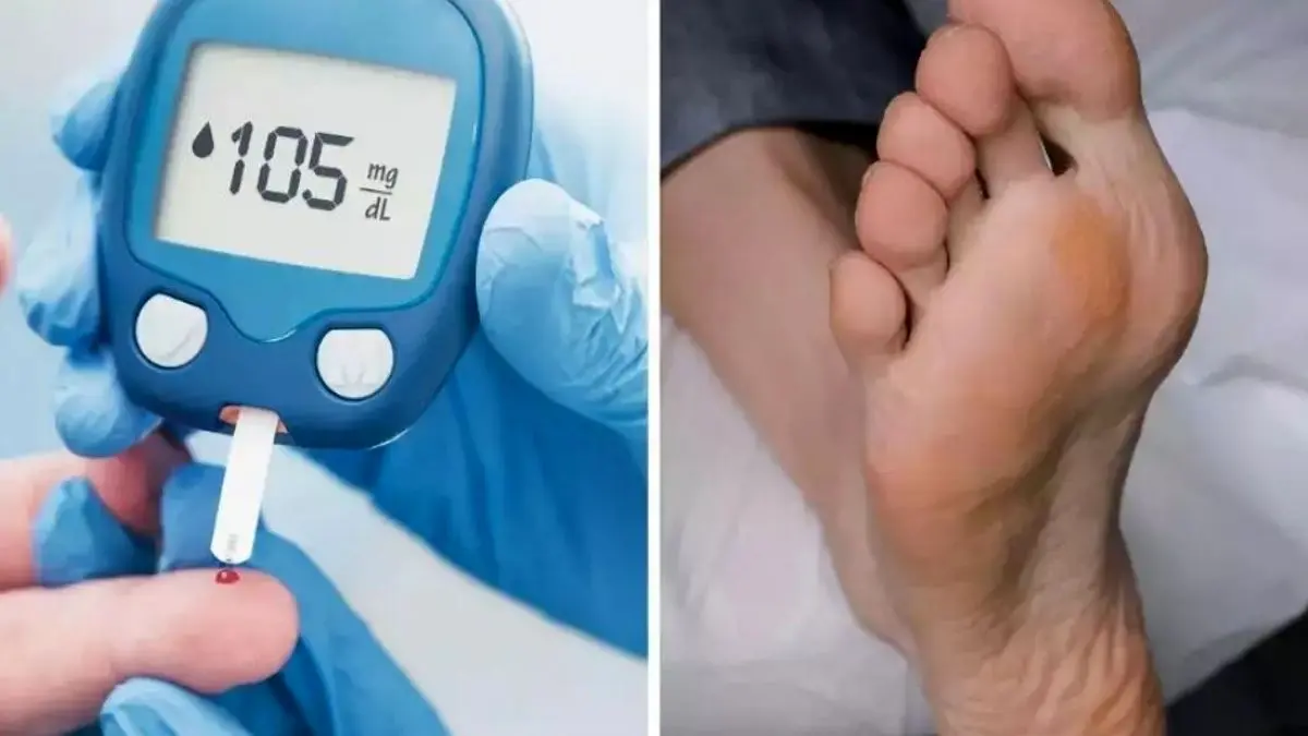 راههای جلوگیری از آسیب چشم ناشی از قند خون