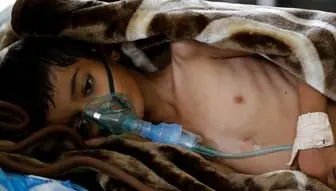 یمن از گرسنگی در حال مرگ است